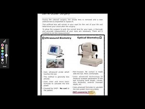 Video 2 - Eye measurements