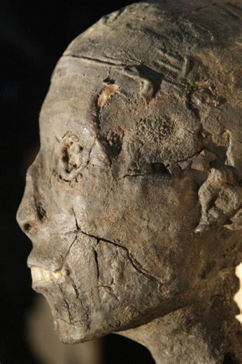 🔍 A Face That Defied Time.. The Features of the "Boy King" Tutankhamun Take a close look at these details.. This isn't just an archaeological image; it's a direct encounter with the features of the world’s most famous ancient ruler, King Tutankhamun. 🏺✨ This profile view of the mummy (dating back over 3,300 years) reveals the incredible precision of ancient Egyptian preservation: The Brow and Nose: Remarkably preserved thanks to the mastery of mummification. The Teeth: Clearly visible, telling
