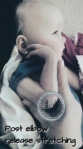 18K views · 619 reactions | Day 18 Arthrogryposis Awareness - #arthrogryposis #treatments #rarecondition #awarenessmonth #june2023 #physicaltherapy #occupationaltherapy #surgery #braces #bracing #casting #regression #AMCStrong | Team AMC Ana | Facebook