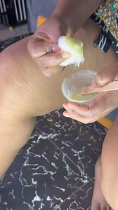 Remove dark inner thighs,dark knees and knuckles with this remedy, tested and trusted Stay healthy 😀 | Healthy lifestyle with omah