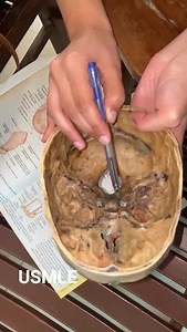 Anterior cranial fossa | Magic Anatomy