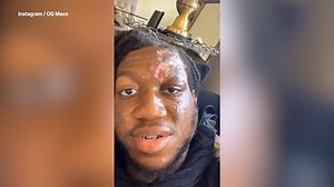 OG Maco opens up about skin eating disease