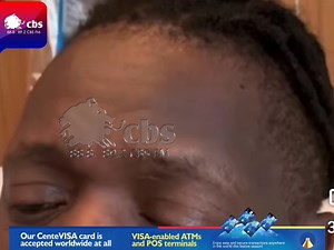 4.7K views · 169 reactions | Omuyimbi Jose Chameleone ali muddwaliro e Newton mu America alaze obutali bumativvu eri bannansi abamu abamufulumyako amawulire agamwewuunyisa. | CBS FM | Facebook