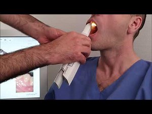 Prise d'empreinte dentaire numérique