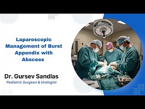 Laparoscopic Management of Burst Appendix with Abscess – Dr. Gursev Sandlas