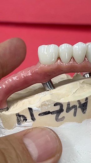 For long span pontics | CEO Luke Kahng