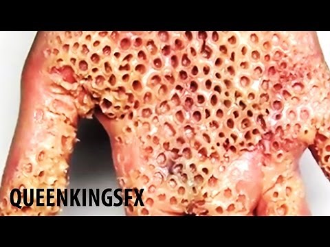 Trypophobia Top 10 Most Popular Images!