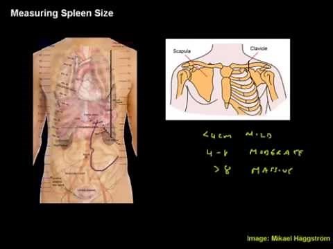Measuring Spleen Size - Clinical Skills Made Easy