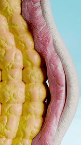 Weight Loss Comparison Man Body Transformation Stock Footage Video (100% Royalty-free) 3988151311 | Shutterstock