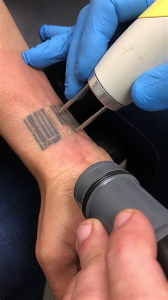 52K views · 292 reactions | We are your permanent make up removal and...