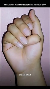 Extra Finger Explained 🤔 #shorts #viral