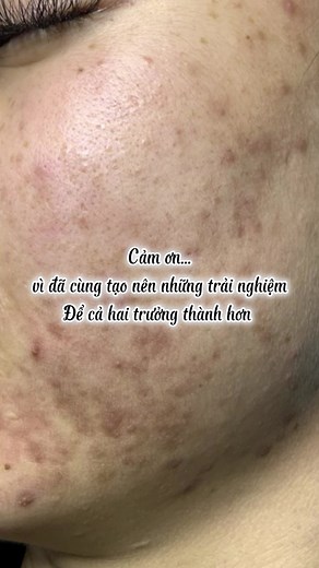 Hana spa and clinic trên TikTok