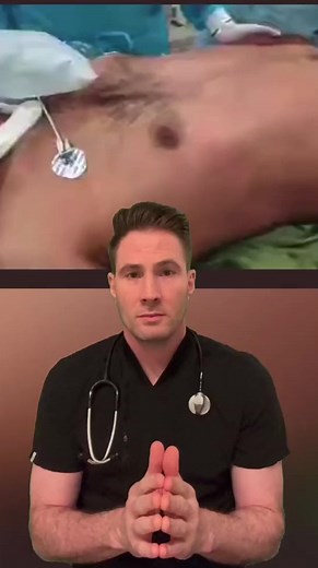 Flail chest from multiple rib fractures. #flailchest #brokenribs #trauma #atls #doctor | Mary Johnson