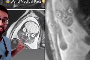 Dr reveals pregnant women aren't shown MRI scans as babies look like 'demons'