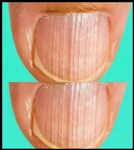 😲Having Striped Nails Could Mean That Your Body Is... More Details below⤵️ | Hug The Dogs