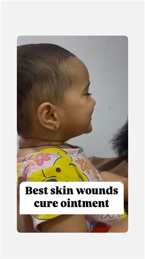 Minnie Thakur💫 Golden Drops Oil,Mom Influencer on Instagram: "🌟 Benefits of T-Bact Ointment • Treatment of Bacterial Skin Infections: T-Bact 2% Ointment is an antibiotic that works by stopping the growth of bacteria that cause skin infections. • It blocks the production of essential proteins that bacteria need to survive. • It is effective in treating skin conditions such as: • Boils • Impetigo • Infected hair follicles • Minor cuts or wounds with infection • The ointment is generally well-tol