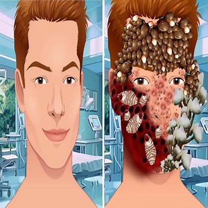 Remove Dog Ticks, Big Pustules, Maggots on the face | Lline Theodora