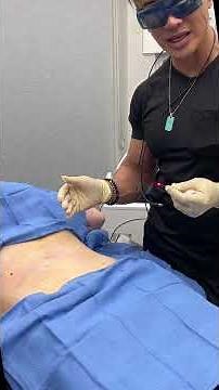 MUFFIN TOP Fat Melting AND Skin Tightening Treatment with Endolift by Dr. TJ Tsay @ Ageless MD