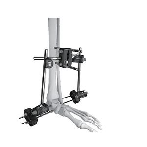 [Hot Item] Fix Miniature External Fixation Support