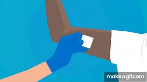 Fitting the contraceptive implant | NHS on Make a GIF
