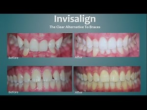 Daytime Crown Point Dental Care