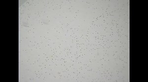 Sperm motility. | Medicine, Biomedicine, and Medical Biology: Update