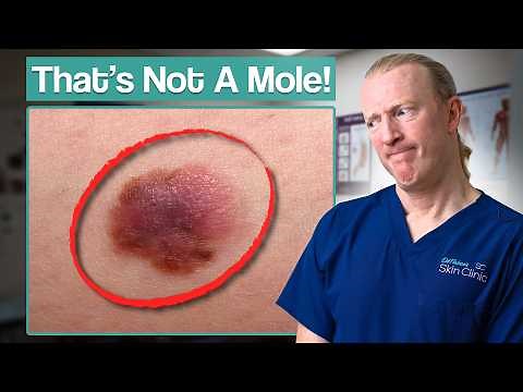 Skin Cancer: The Types, Causes, Prevention & Treatments