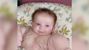 4.3K views · 48 reactions | 'Baby Hulk': Bebé nace con rara condición genética y su madre asegura que es una superheroína. ✅ Sigue esta y más noticias las 24 horas en ViX  https://bit.ly/37q2XXw | Univision Miami | Facebook