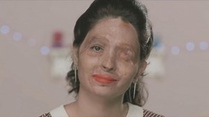 Burn Victim Creates Powerful Make-Up Tutorial to Call for an End to Acid Attacks