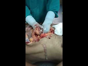 Live postmortem examination from GMC mortuary