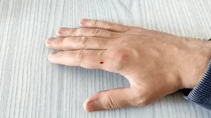 「テーブルの上に血まみれの引っかき傷がある手のひら」の動画素材（ロイヤリティフリー）3637783869 | Shutterstock