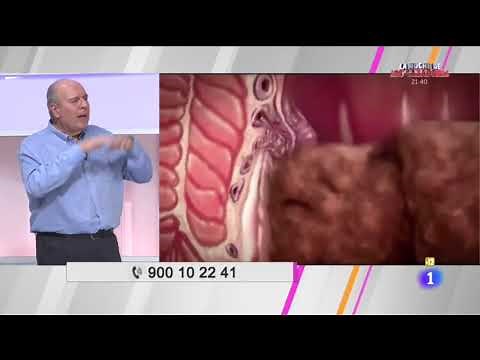 Dr. Ignacio González discusses anal fissures and their treatment on TVE.