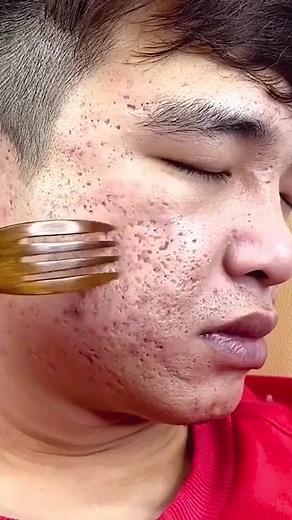 Green Mask Stick Benefits and Trending Skincare Products