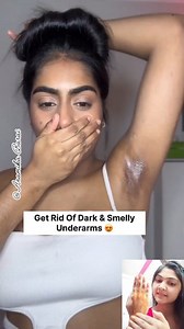 1.4M views · 8.2K reactions | Get Rid Of Dark & Smelly Underarms/Dark Underarms Whitening Hack #shorts #skincare #darkunderarms #underarmswhitening #underarmskincare #underarmserum #youtubeshorts #fbreelsfypシ゚ #fbreels #viralreels #trendingreelsvideo #trendingreels #trendingnow #reelsviral #reelsviralシ #reelsviralfb #reelsvideoシ #reelsvideo | Anamika Barai | Facebook