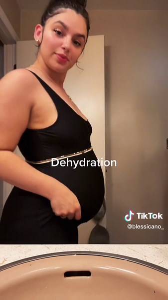 #hgmommasurvivor #hyperemesisgravidarum | severe dehydration symptoms