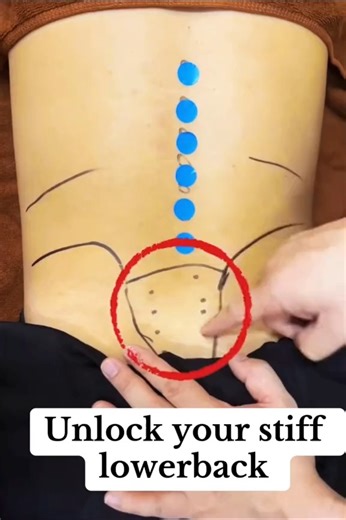 Unlock your stiff lower back. #massage #massagetherapy #lowerback #lowerbackpain #lowerbackpainrelief | Back Pain Treatment