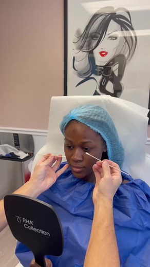 Alarplasty: Harmonizing Natural Features for Balanced Beauty
