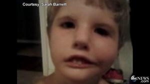 Surgery Enables 6-Year-Old Boy to Smile