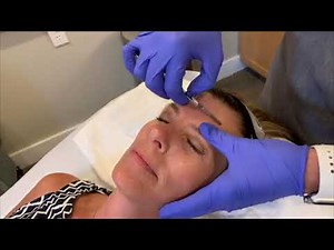 Live Demonstration | Dermaplane and Diamond Glow