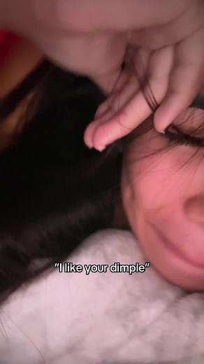 Understanding Types of Dimples and Their Charm