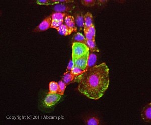 Tumor associated glycoprotein 72 - Alchetron, the free social encyclopedia