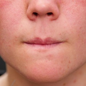 2.3K views | Smart Syringe Hacks! Thanks for watching! Please be aware that this video is for entertainment purposes only and techniques shown should not be attempted at home! | Hungry Panda | Facebook