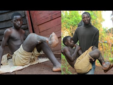 ''Please Cut Off My Leg To Save My Life" | PATH OF PAIN With PETER BAVUGAMENSHI