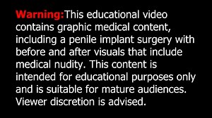 Complete Guide to Indian Malleable Penile Implant Surgery _ Full Procedure (1)