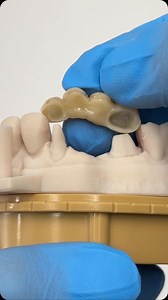 5.6K views · 56 reactions | Small Double Pontic Bridge! | CEO Luke Kahng | Facebook