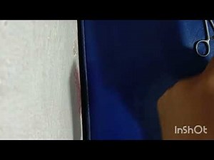 How to Give an Intramuscular Injection in the Buttocks | IM Injection Technique Explained