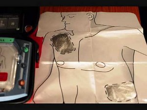 Quick AED Pads Placement