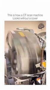 #ctscanmachine #CTscan | Doctor Ayurveda- BAMS