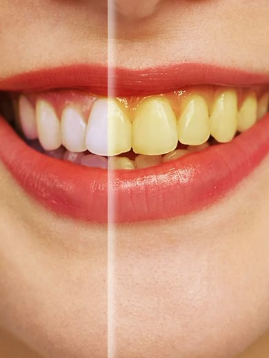 Natural Toothpaste Magic for White Teeth in 3 Minutes