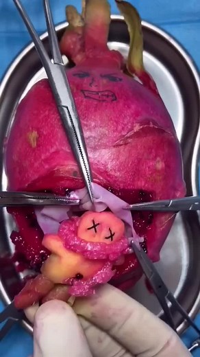 Follow me to learn more#cesarean #surgery #fyp #GEICOLipSync